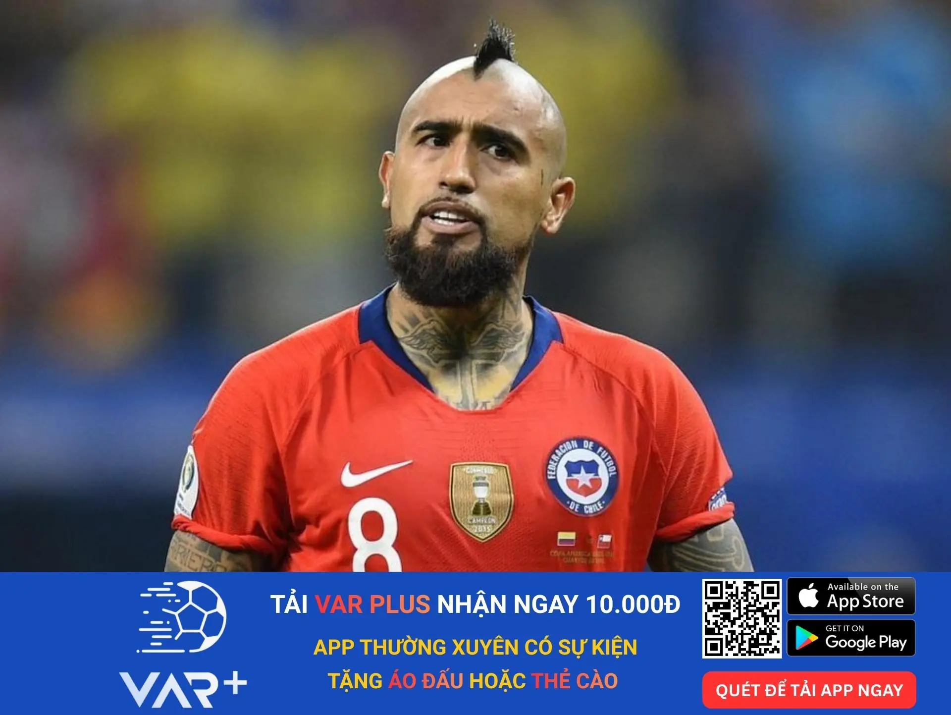 20 kiểu tóc độc lạ, dị nhất trong lịch sử các kỳ World Cup 18 Arturo Vidal (Chile) – "Hàng rào hình học" (2014)