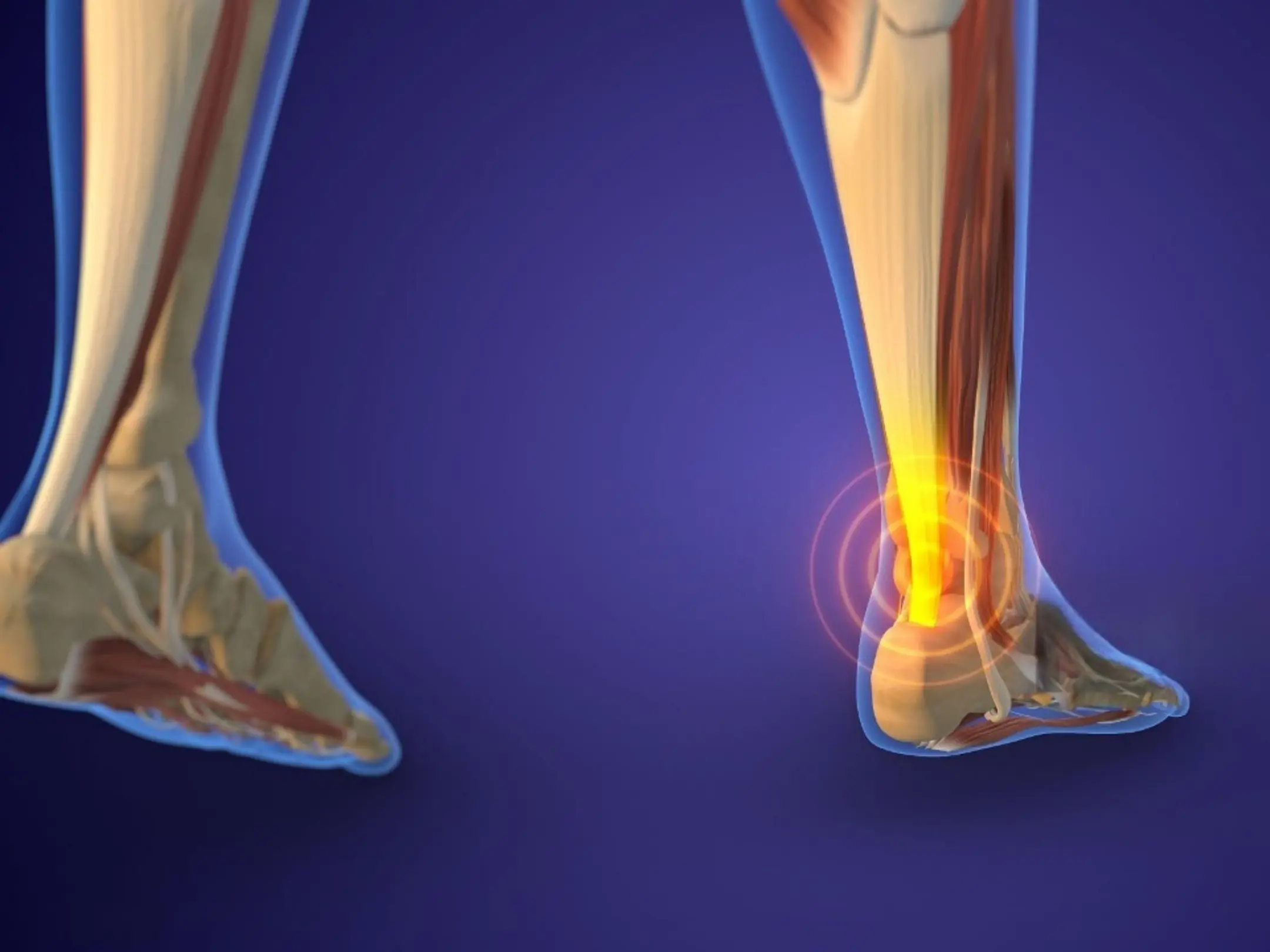 Vị trí gân Achilles