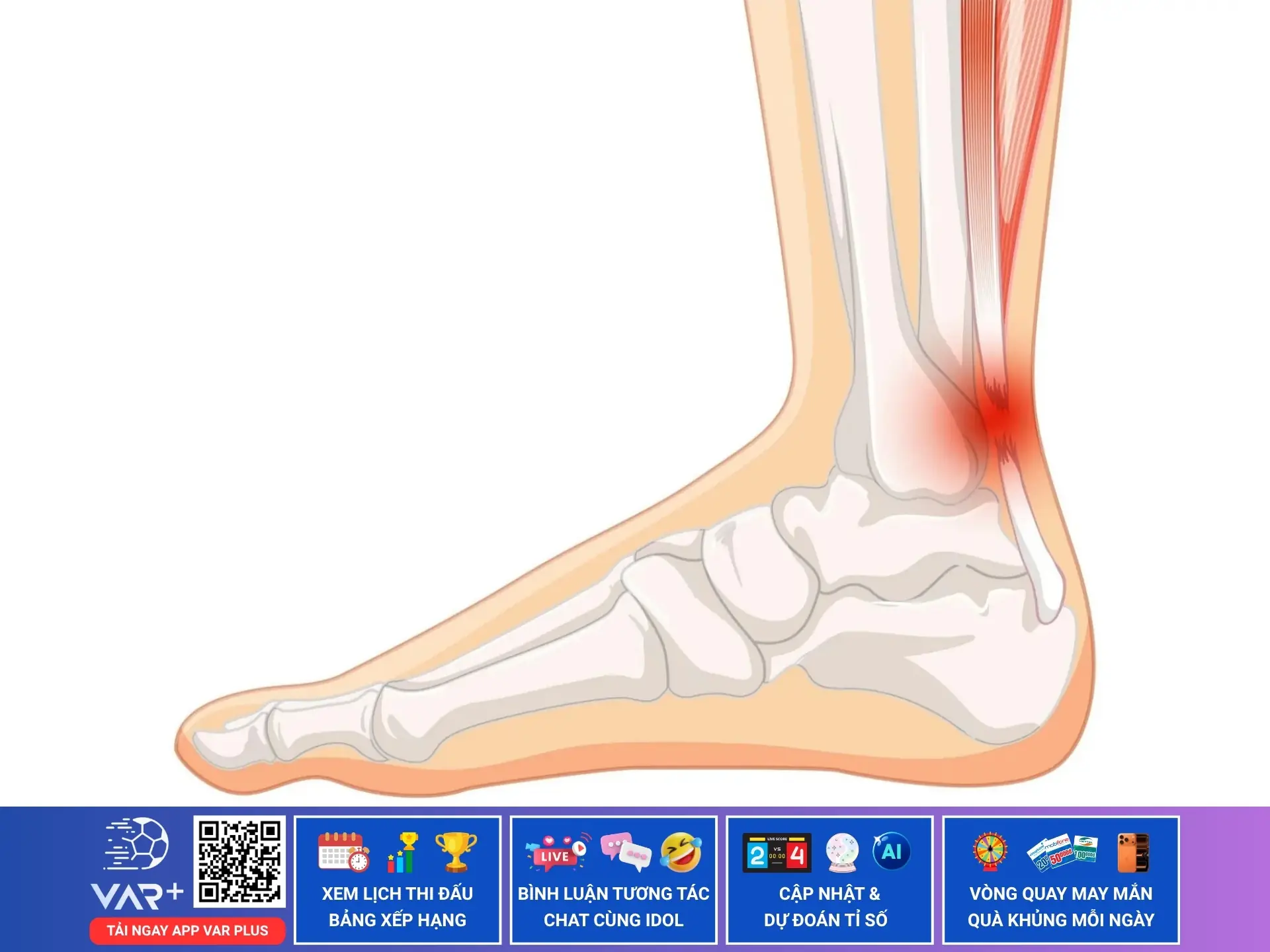 Đứt gân Achilles, cơn ác mộng kinh hoàng với các vận động viên thể thao