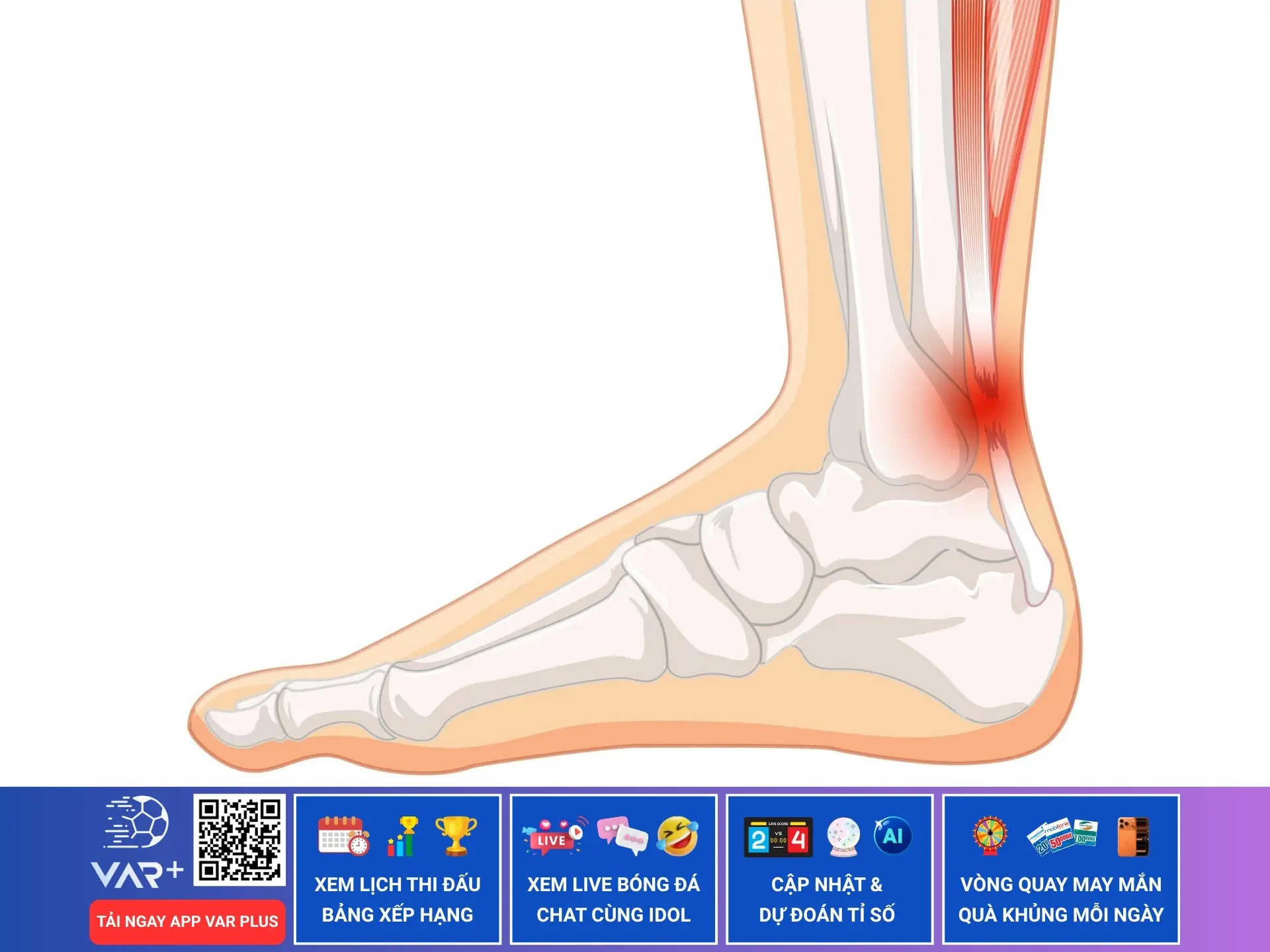 Đứt gân Achilles, cơn ác mộng kinh hoàng với các vận động viên thể thao
