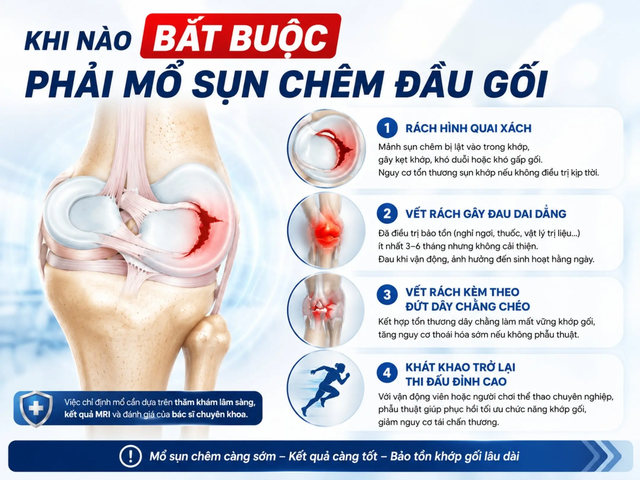Khi nào bắt buộc phải mổ sụn chêm đầu gối